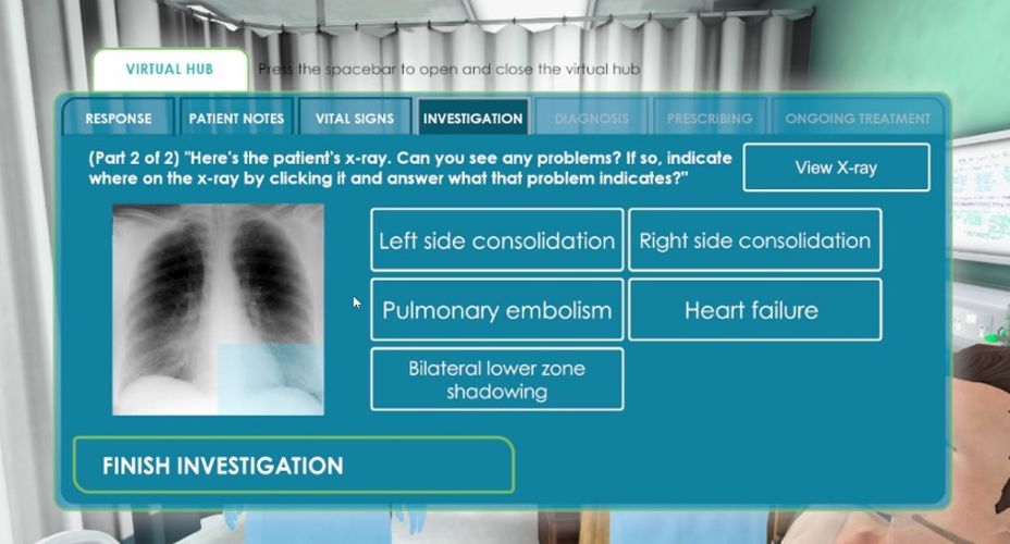 Patient Xray